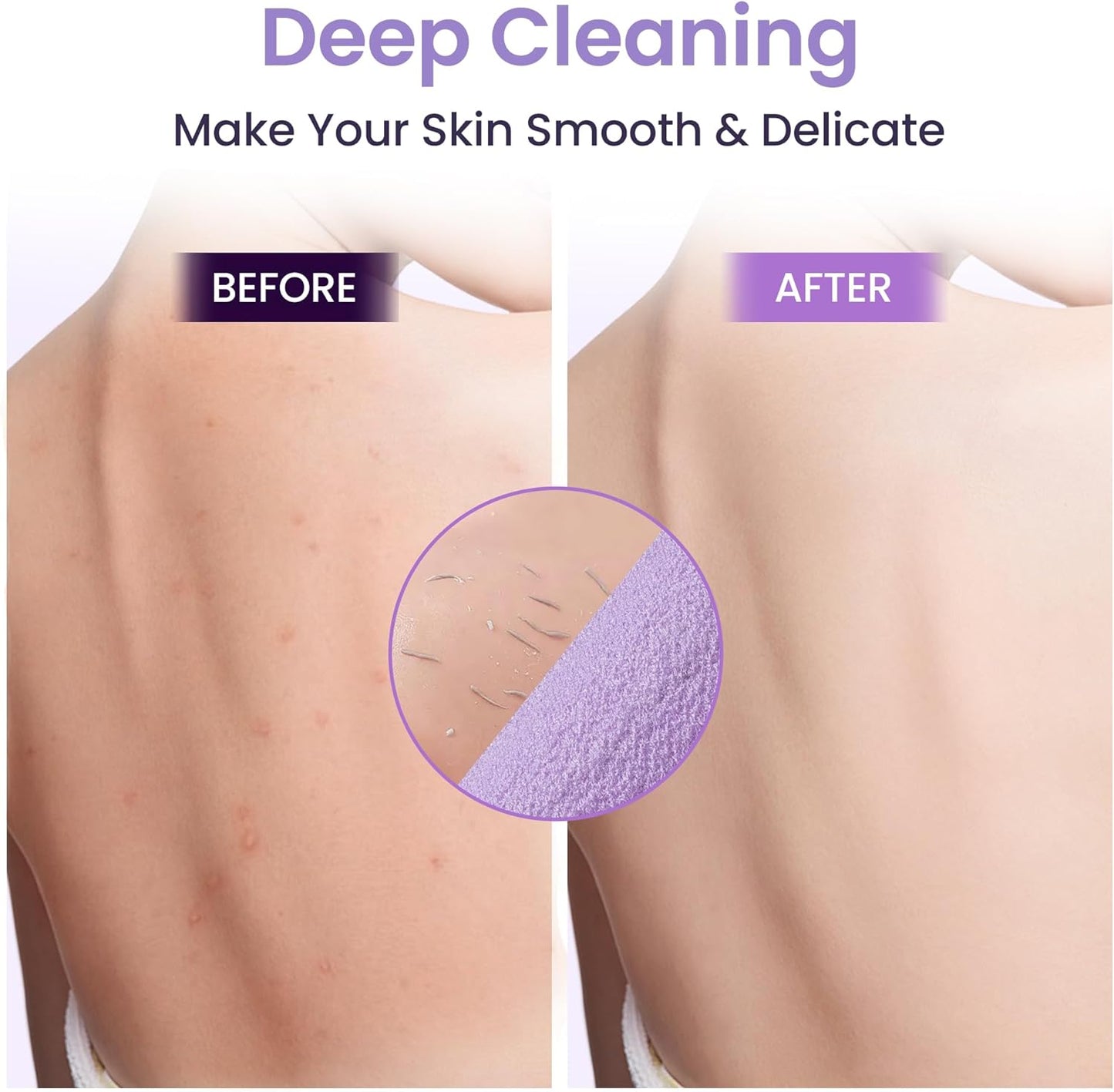 3 Pcs Double-Sided Back Exfoliator Body Scrub Towel, Exfoliating Back Scrubber with Handles,Exfoliating Washcloth Bath Tool in Shower, Stretchable Back Washer to Deep Cleans Skin (Purple)